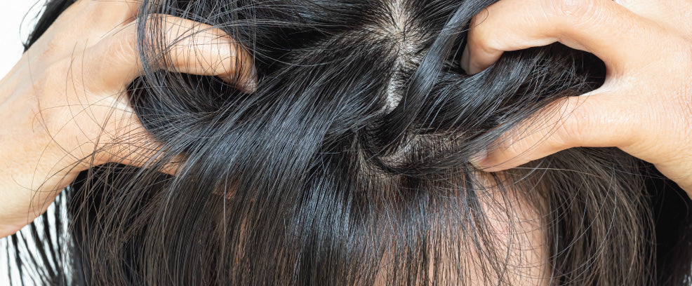 Oily and Greasy Hair